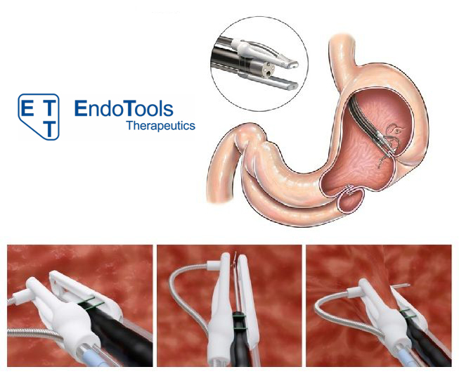 endo tools